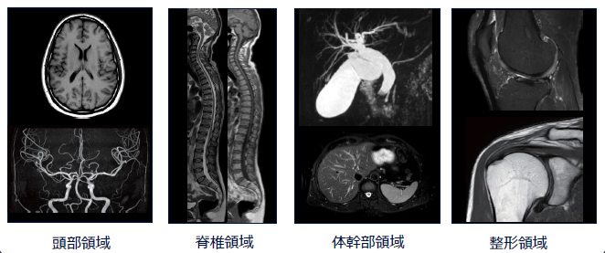MRI検査画像