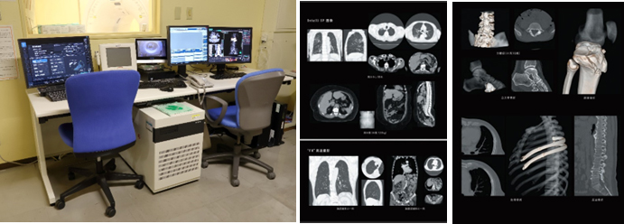 CT (富士フイルム社製 16列Multi slice CT Supria Advance FR)2